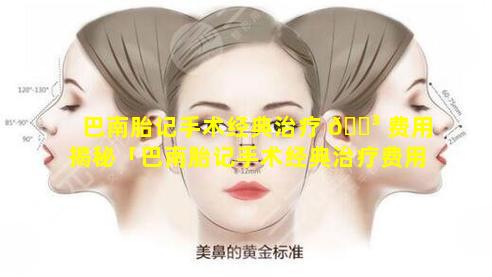 巴南胎记手术经典治疗 🌳 费用揭秘「巴南胎记手术经典治疗费用揭秘是多少」